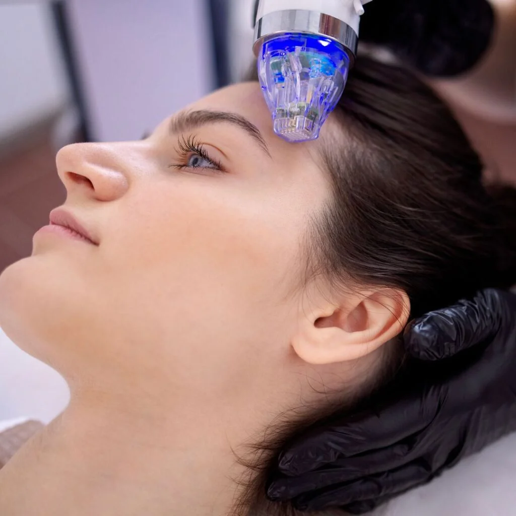 Radiofrequenz und Microneedling
